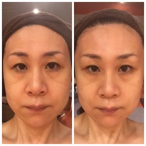 聴衆 意志 インポート 化粧品 高い L Techs Jp